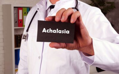 Managing Achalasia Treatment: A Smoother Road Ahead